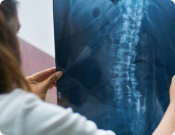 Un médecin tenant un rapport de radiographie