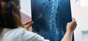 A doctor holding a radiograph report.