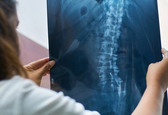 A doctor holding a radiograph report.