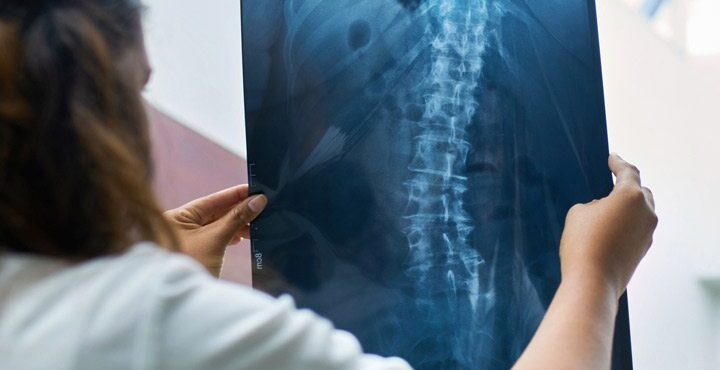 A doctor holding a radiograph report.